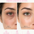 Glowvu Eye Therapy