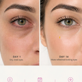 Glowvu Eye Therapy